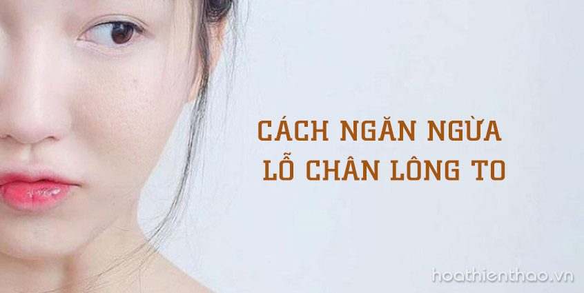 5 Cách ngăn ngừa tắc nghẽn lỗ chân lông đơn giản