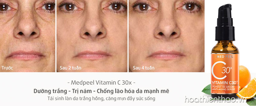 Tinh chất vitamin C 30x Medpeel