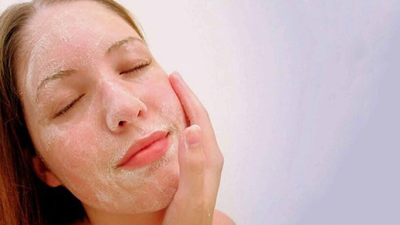 6 điều cần tránh để sở hữu làn da như ý - Hoa Thiên Thảo