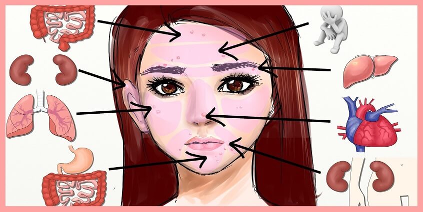Vị trí mụn mọc trên mặt nói lên điều gì?