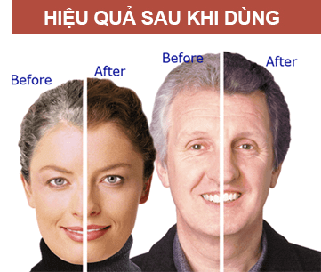 [Chia sẻ] Tạm biệt mái tóc bạc nhờ Grey Away