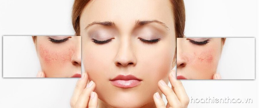 Các loại kem dưỡng da mùa đông tốt nhất - Hoa Thiên Thảo
