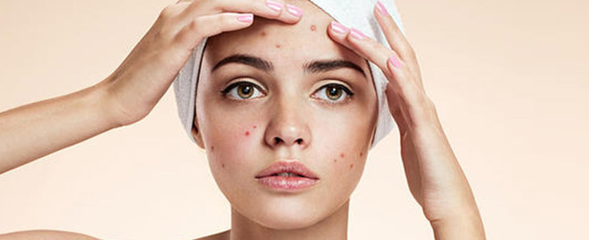 Các sai lầm khiến làn da bạn gái ngày càng mất đi vẻ tươi sáng - Hoa Thiên Thảo