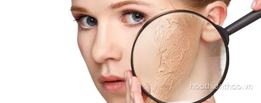 Cách chống lão hóa da mùa đông hiệu quả - Hoa Thien Thao Cosmetics