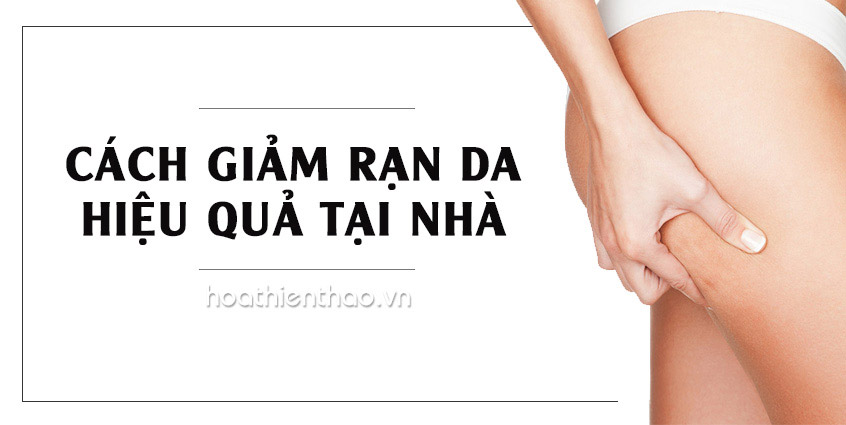 Cách giảm rạn da hiệu quả tại nhà