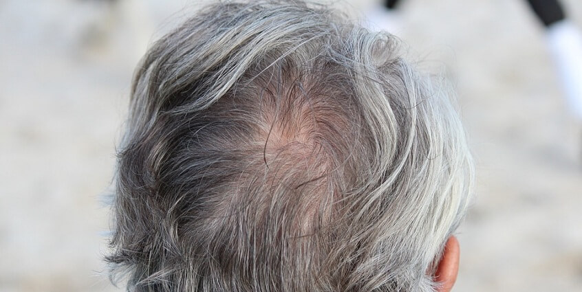 Cách trị tóc bạc hiệu quả nhất cho người cao tuổi