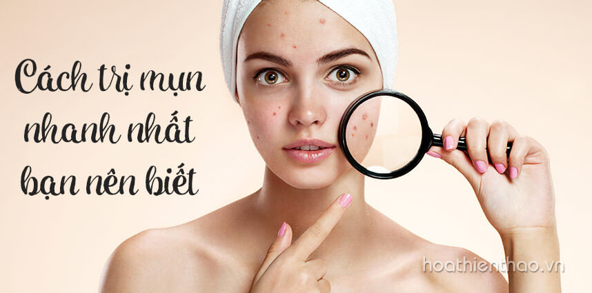 Cách trị mụn nhanh nhất bạn nên biết - Hoa Thien Thao Cosmetics