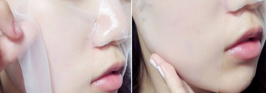 Cách trị mụn nhanh nhất bạn nên biết - Hoa Thien Thao Cosmetics