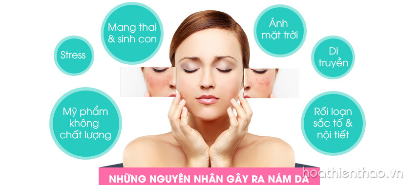 Cách trị nám da từ bên trong an toàn hiệu quả cho tất cả mọi người