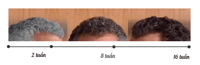 [Chia sẻ] Tạm biệt mái tóc bạc nhờ Grey Away