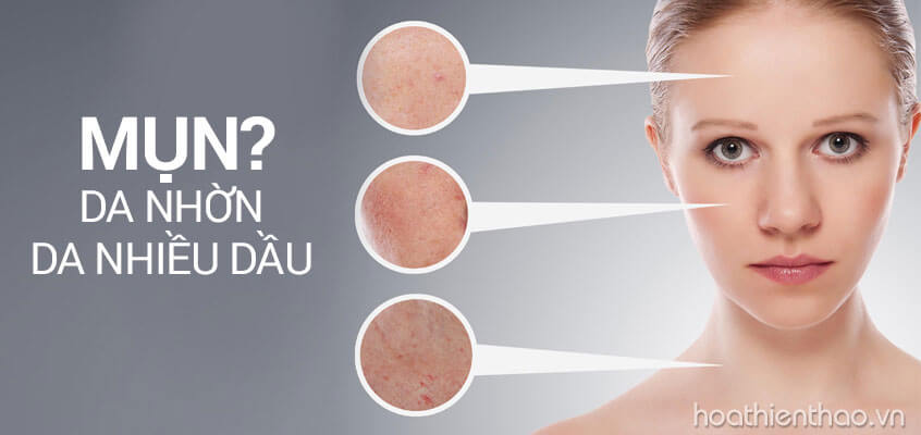 Cách chăm sóc da nhờn hiệu quả bạn nên biết