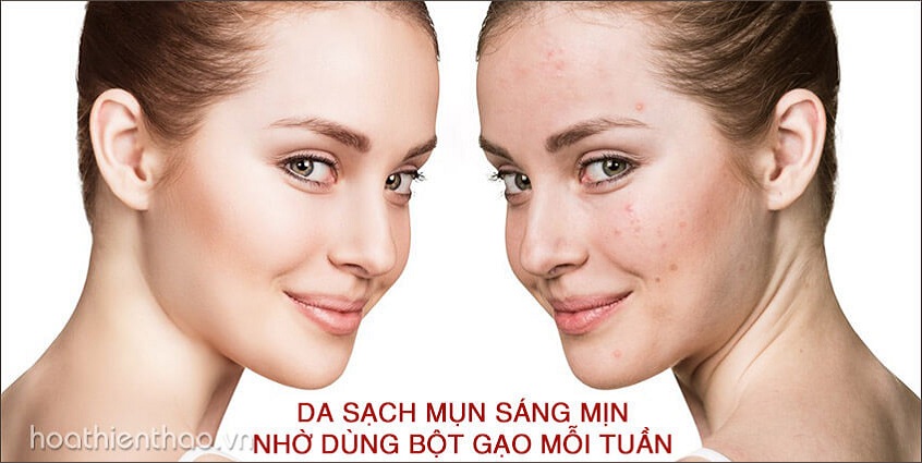 Da sạch mụn sáng mịn nhờ dùng cám gạo mỗi tuần