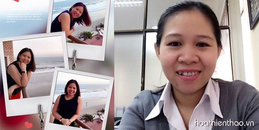 Da trắng hết sạch thâm, sẹo mụn - Phép màu chỉ sau 3 tuần