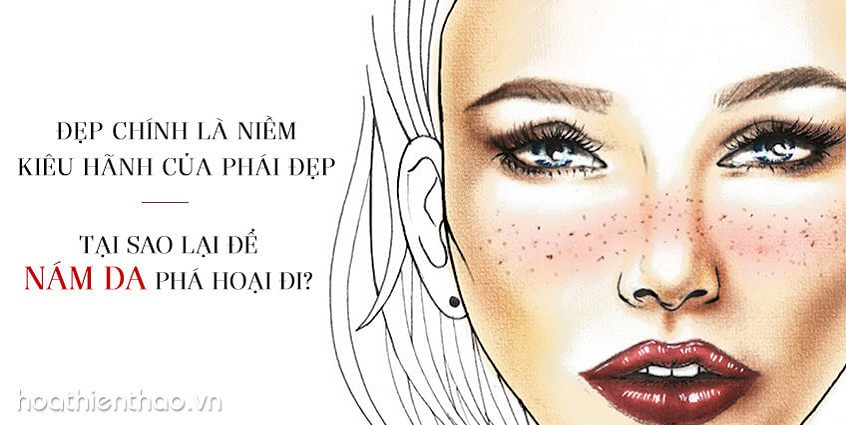 Cách điều trị nám da hiệu quả cho phái đẹp