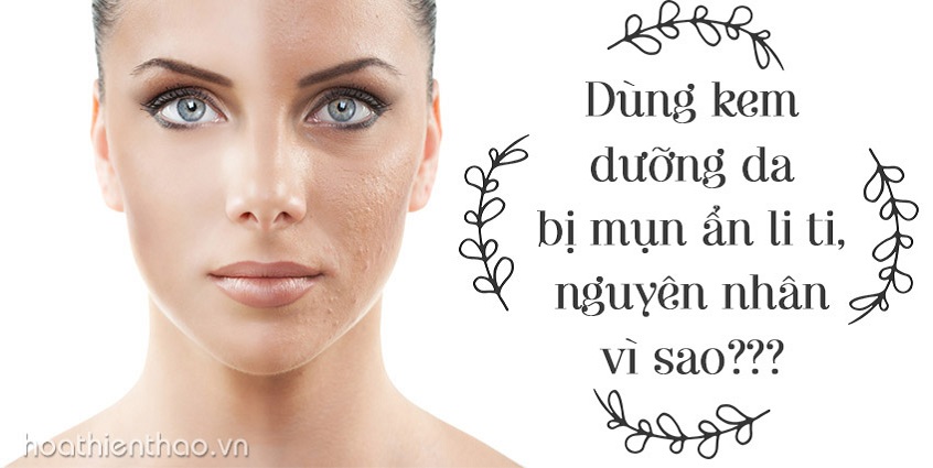 Nguyên nhân dùng kem dưỡng da bị mụn ẩn li ti