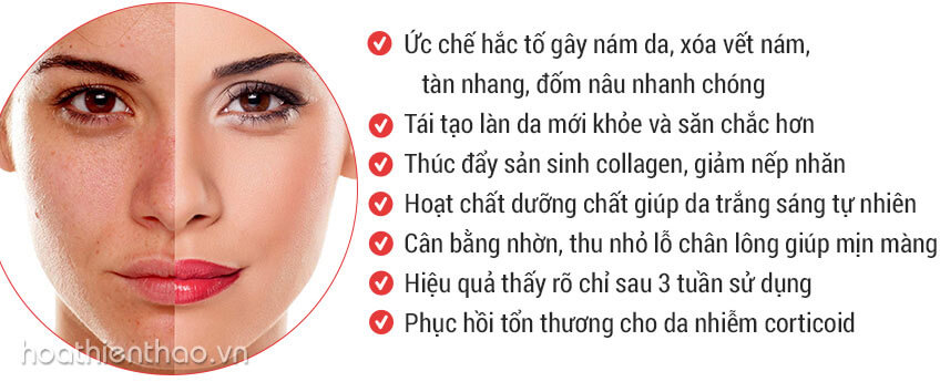 Phái đẹp đánh bại nám da nhờ Koee Pro