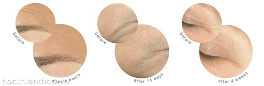 Lợi ích của collagen đối với da