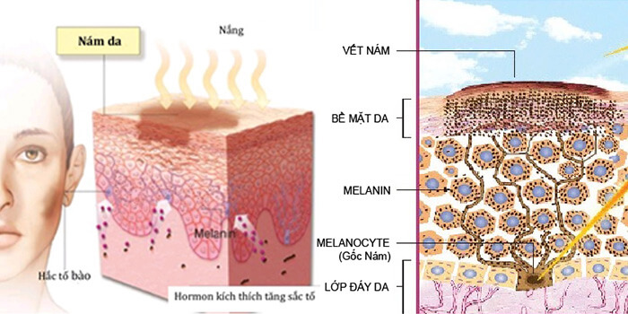 Lời khuyên chăm sóc da khỏe đẹp cho phụ nữ Châu Á
