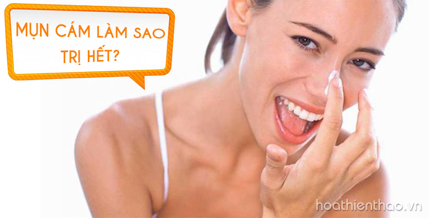 Mụn cám làm sao trị hết?
