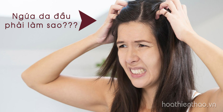 Ngứa da đầu phải làm sao?