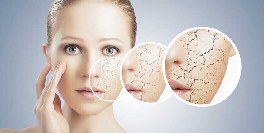 Nguyên nhân và cách khắc phục làn da khô