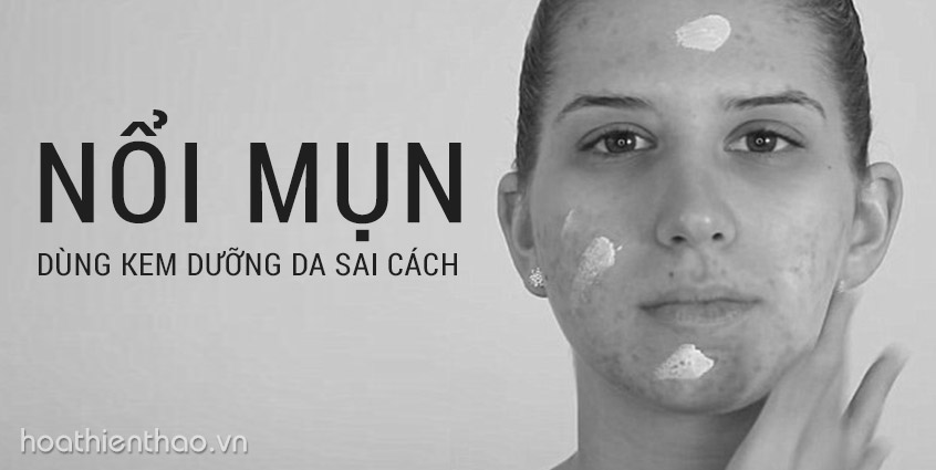 Nổi mụn khi dùng kem dưỡng da sai cách - Hoa Thiên Thảo
