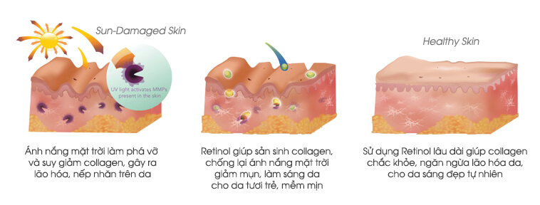 Retinol – thành phần dưỡng da 'hot' khiến tín đồ làm đẹp mê mẩn
