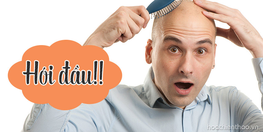 Rụng tóc không trị sẽ dẫn đến hói đầu