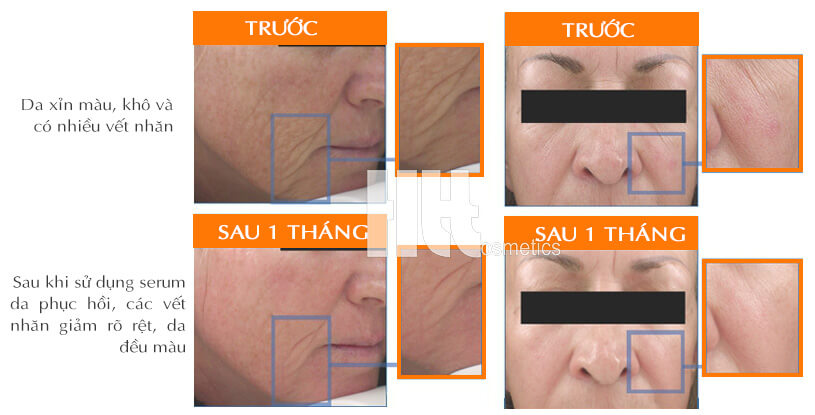 Serum trắng da chống lão hóa Medpeel Vitamin C 30x Retinol - Mỹ Phẩm Hoa Thiên Thảo