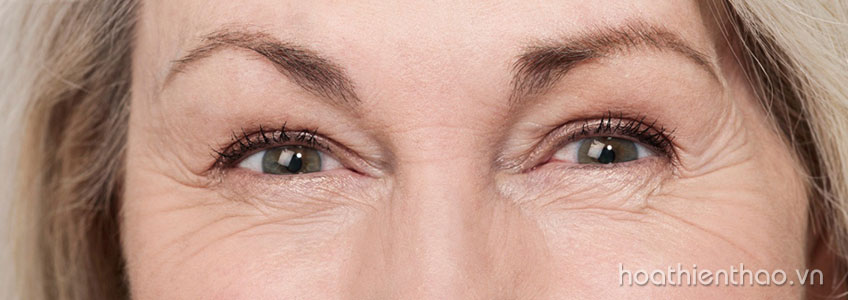 Tại sao lại cần dưỡng da vùng mắt?