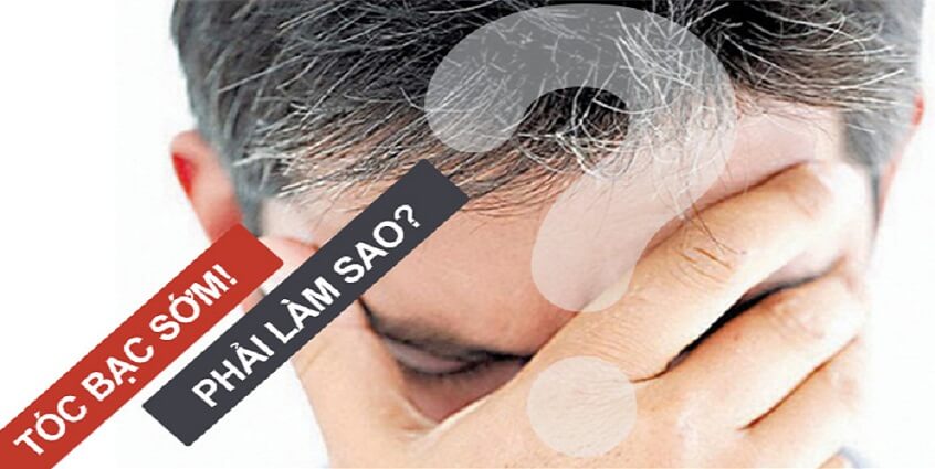 Tóc bạc sớm và giải pháp trị tóc bạc hiệu quả nhất