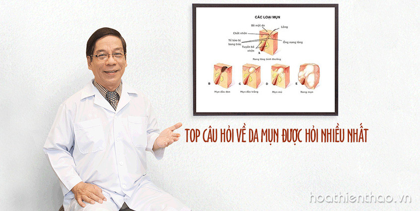 TOP câu hỏi về da mụn được hỏi nhiều nhất