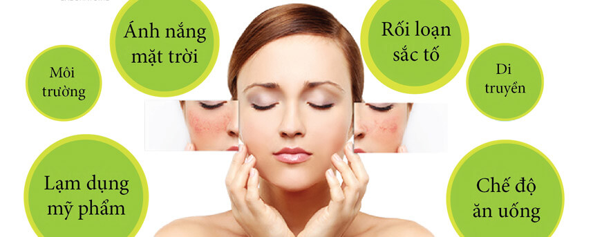 Các top viên uống trắng da trị nám tốt nhất hiện nay - Hoa Thiên Thảo