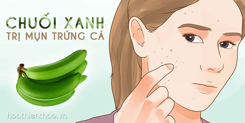 Trị mụn trứng cá với chuối xanh, lạ mà hiệu quả