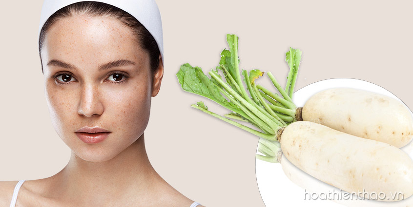Trị nám hiệu quả với củ cải trắng