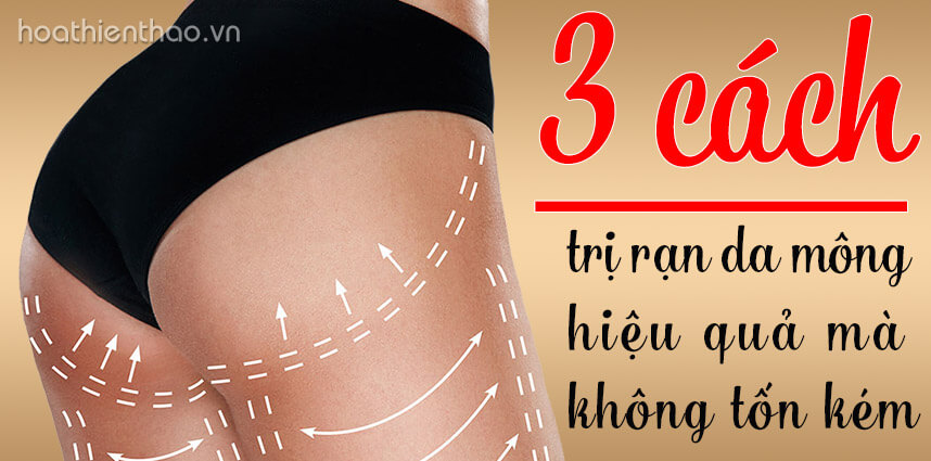 3 cách trị rạn da mông hiệu quả không tốn kém - hoathienthaovn