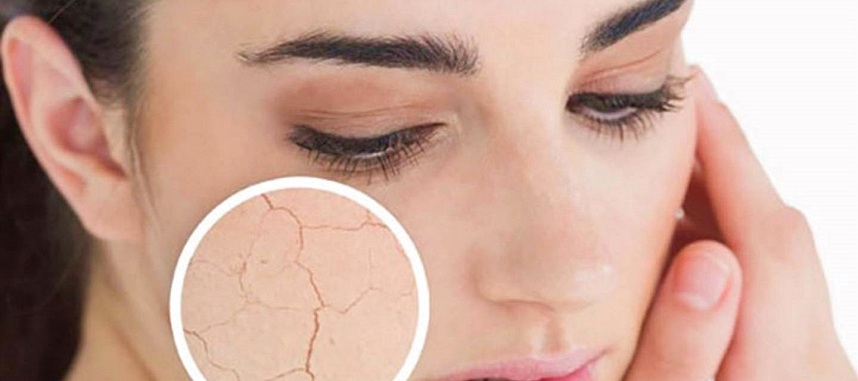 4 dấu hiệu lão hóa chính: Sạm - Khô - Nhăn - Chùng - Nhão