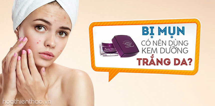 Bị mụn có nên dùng kem dưỡng trắng da - Hoa Thiên Thảo