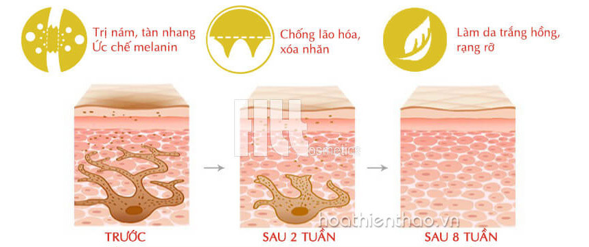 Bộ trị nám đón Tết Newskin Nhật Bản chất lượng cao - Hoa Thiên Thảo