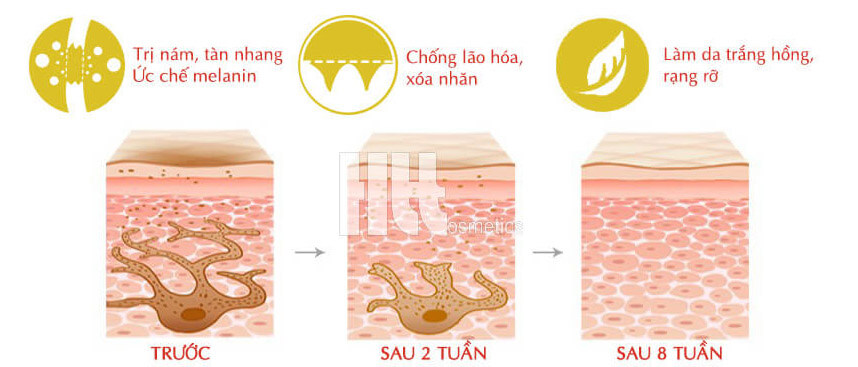 Bộ trị nám Newskin và Kireina - Đâu là sản phẩm tốt nhất - Hoa Thiên Thảo
