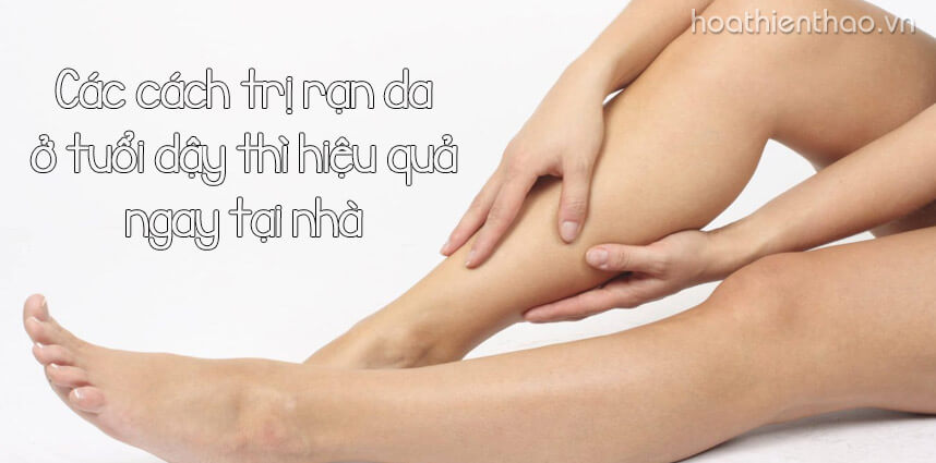 Các cách trị rạn da ở tuổi dậy thì ngay tại nhà - Hoa Thien Thao Cosmeitcs