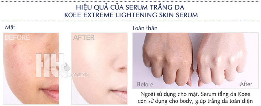 Bỏ túi cách làm serum dưỡng da handmade tại nhà - Hoa Thiên Thảo