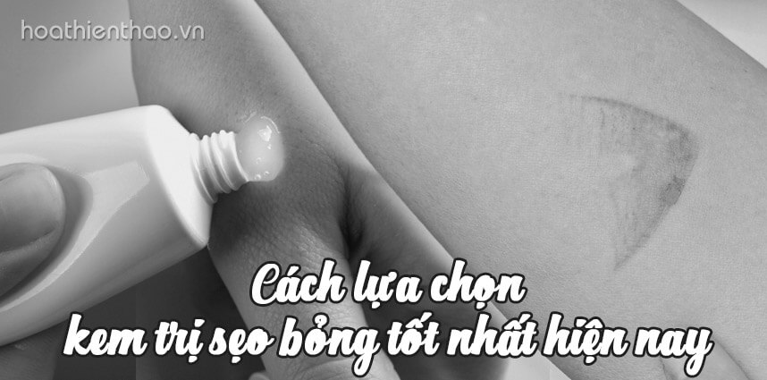 Cách lựa chọn kem trị sẹo bỏng tốt nhất hiện nay - Hoa Thiên Thảo