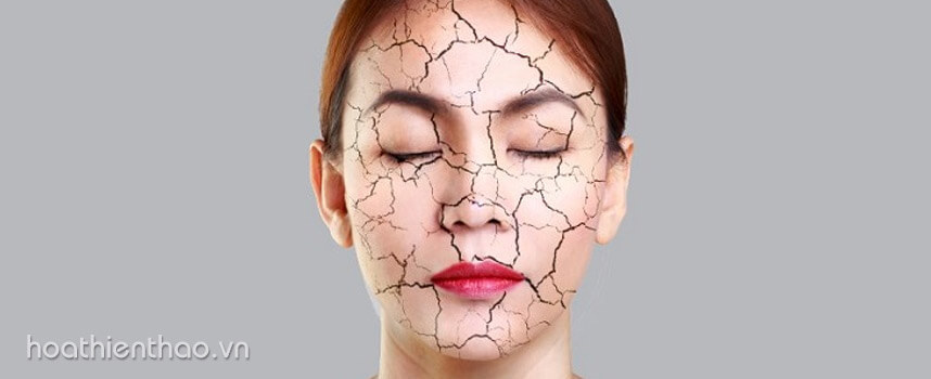 Cách tẩy tế bào chết vào mùa đông hiệu quả - Hoa Thien Thao Cosmetics
