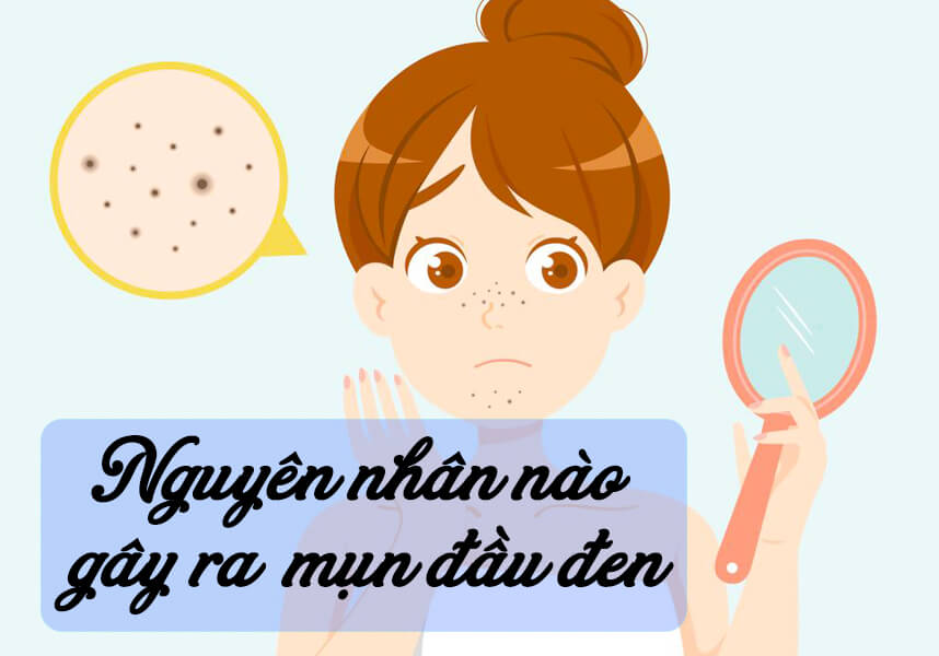 Làn da bất khả xâm phạm nhờ những cách trị mụn đầu đen tận gốc - HoaThienThao