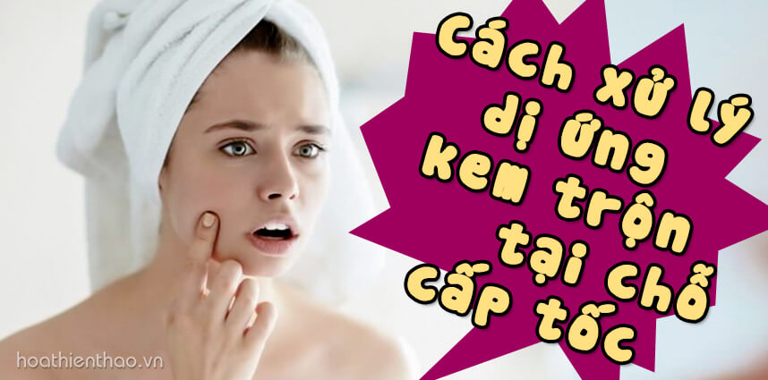 Cách xử lý dị ứng kem trộn tại chỗ cấp tốc - HoaThienThao