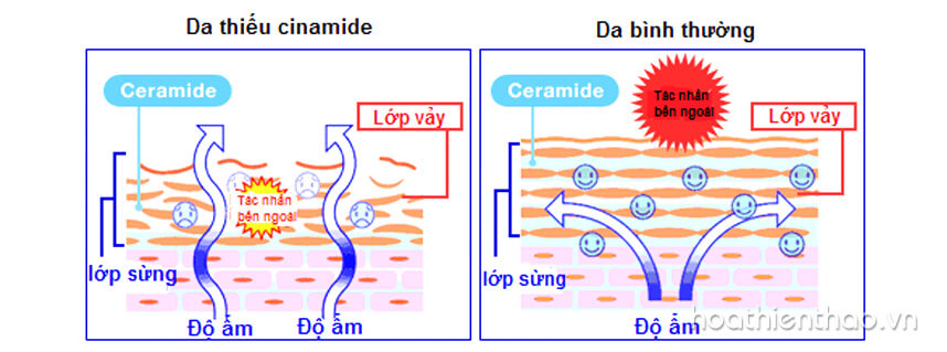 Ceramide là gì? Tác dụng của Ceramide đối với da - Hoa Thiên Thảo