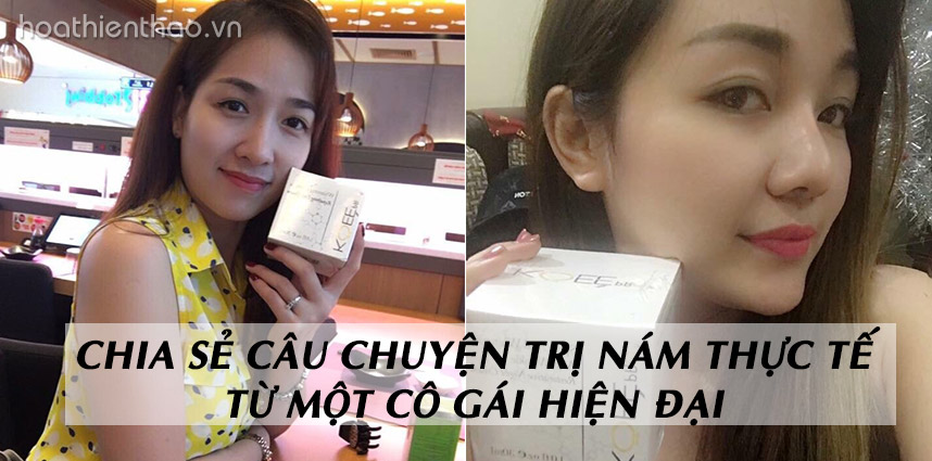 Chia sẻ câu chuyện trị nám thực tế từ một cô gái hiện đại - Hoa Thiên Thảo
