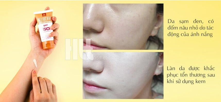 Có nên dùng Gel chống nắng Heliocare SPF 50 - HoaThienThao