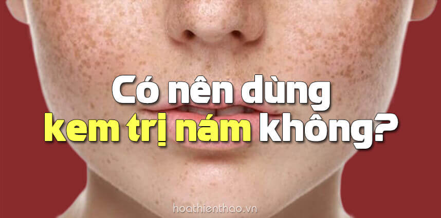 Có nên dùng kem trị nám không - HoaThienThao